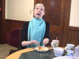 ¿como vive la mujer que recibio un trasplante de cara hace cinco anos? ¿como vive la mujer que recibio un trasplante de cara hace cinco anos?