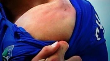 el jugador italiano agredido banco a luis suarez: fue excesiva la sancion el jugador italiano agredido banco a luis suarez: fue excesiva la sancion