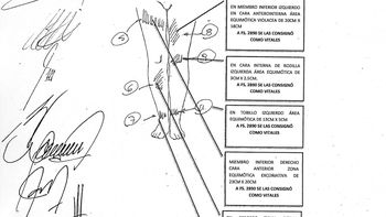 las lesiones que prueban el abuso a angeles rawson las lesiones que prueban el abuso a angeles rawson