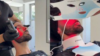 abrieron en palermo el primer gimnasio facial de la argentina y es viral por las reacciones abrieron en palermo el primer gimnasio facial de la argentina y es viral por las reacciones