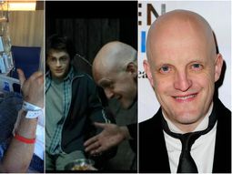 Jim Tavaré accidentado, en Harry Potter y fuera de escena Jim Tavaré accidentado, en Harry Potter y fuera de escena