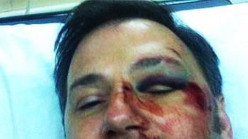 condenan a la mujer que golpeo a un director de escuela en pergamino condenan a la mujer que golpeo a un director de escuela en pergamino