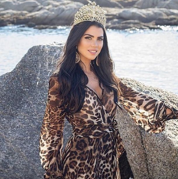 Iba a competir en Miss Universo y le quemaron la cara