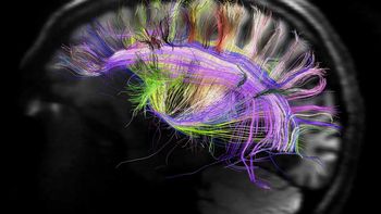cientificos logran eliminar malos recuerdos del cerebro cientificos logran eliminar malos recuerdos del cerebro