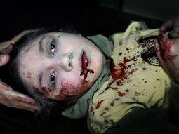 La foto del año 2013 según Unicef: la mirada perdida de una niña herida por una bomba