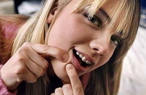  La manera sencilla de eliminar los granos de la cara sin mayores complicaciones