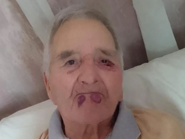 VIDEO: la violenta agresión a un jubilado perpetrada por personal de un geriátrico de Mar del Plata