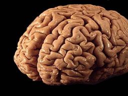 El cerebro humano se arruga