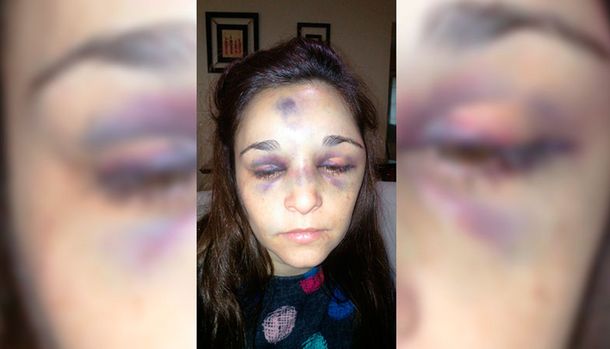 Carla Pereyra fue brutalmente golpeada por su novio