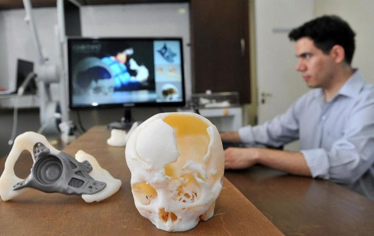 Cada vez más países usan implantes fabricados con impresora 3D
