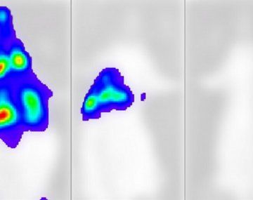 Logran grabar cómo se propaga el virus del covid en el cuerpo y detectan el momento en que mata