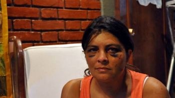 la mujer golpeada en mendoza dijo que la quisieron matar