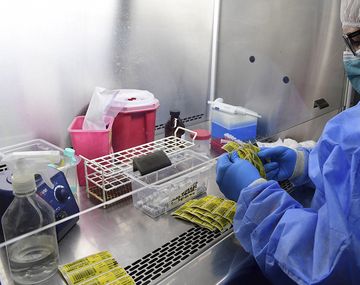 La vacuna contra el coronavirus se empezar&aacute; a producir en Argentina