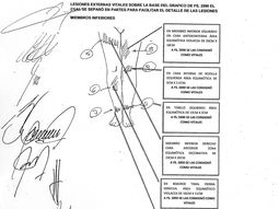 las lesiones que prueban el abuso a angeles rawson las lesiones que prueban el abuso a angeles rawson