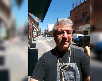 Denunció que vendían droga en una peluquería y sufrió una brutal golpiza