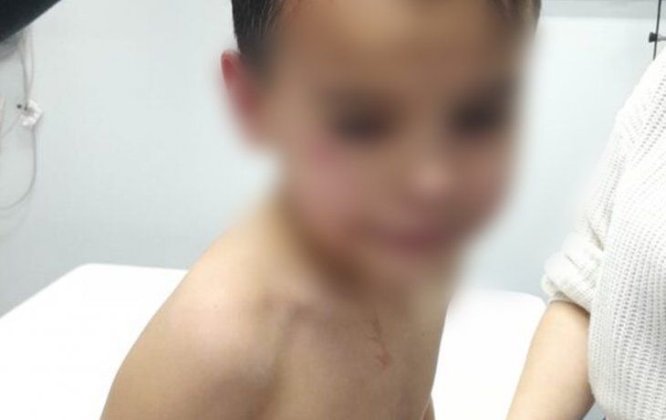 Locura en Castelar: discutieron en un partido, lo baleó e hirió al hijo de 6 años
