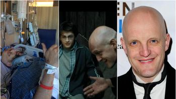 Jim Tavaré accidentado, en Harry Potter y fuera de escena Jim Tavaré accidentado, en Harry Potter y fuera de escena