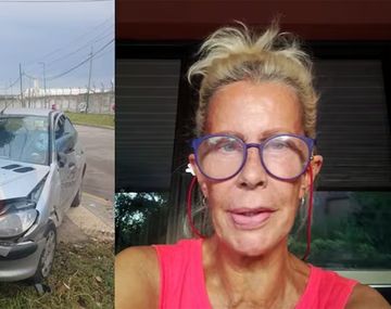 María Valenzuela sufrió un grave accidente de tránsito: Me sacaron un pedazo de carne