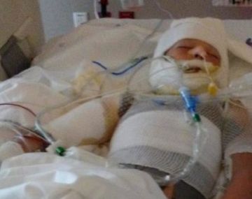 El pequeño sufrió un grave caso de bullying.