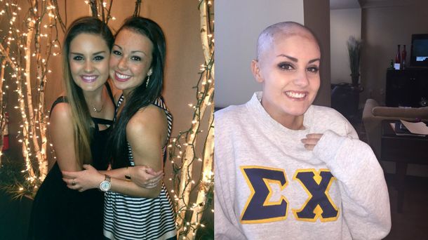 Su pareja tiene cáncer, así que se rapó para ir juntos a una fiesta en el colegio