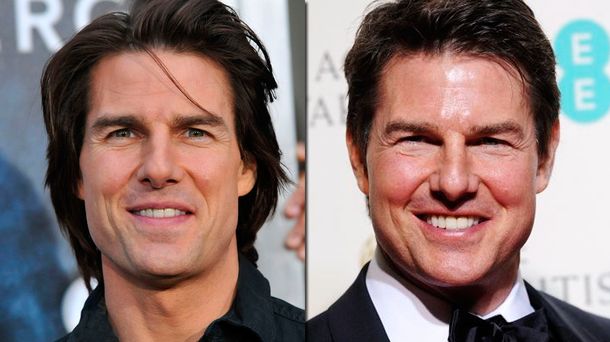 La polémica transformación de Tom Cruise y las comparaciones con René Zellweger
