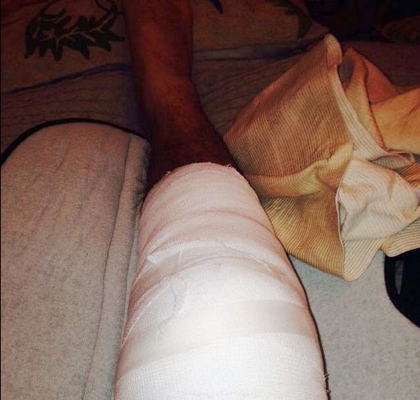 Pedro Alfonso se recupera de su operación en la rodilla