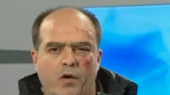 golpean a diputados opositores en el congreso de venezuela golpean a diputados opositores en el congreso de venezuela