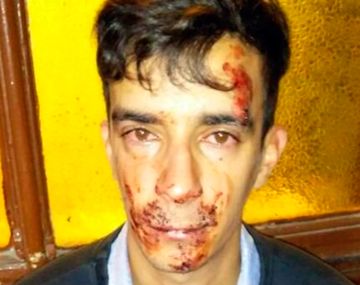 Brutal ataque de una patota a un electricista en La Plata