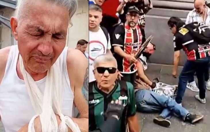 Habló el jubilado al que la Policía de Patricia Bullrich le quebró un brazo: Me tiraron como un misil