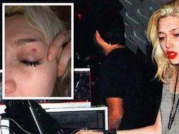 militta bora, nueva victima de violencia de genero: fue golpeada en un asado militta bora, nueva victima de violencia de genero: fue golpeada en un asado