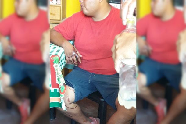 Entró a robar a la casa de un vecino y lo detuvieron por las manchas de sangre que dejó en el camino