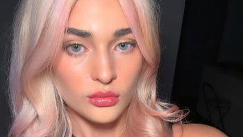 marta fort sorprendio con un nuevo posteo en redes tras el accidente: que compartio marta fort sorprendio con un nuevo posteo en redes tras el accidente: que compartio