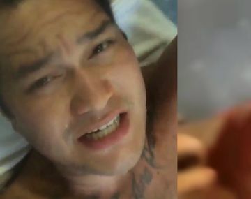 Lo atacó un tiburón y lo fotografió