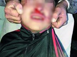 La foto del ladrón linchado por vecinos La foto del ladrón linchado por vecinos