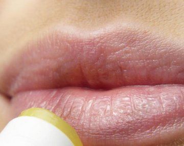 ANMAT prohibió unos bálsamos labiales: qué marca no hay que comprar