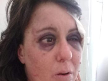 Comisario de San Clemente del Tuyú Roberto Romero acusado de golpear a un paciente psiquiátrica