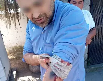 El chofer fue baleado este miércoles durante un intento de asalto.