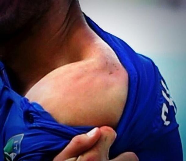 El jugador italiano agredido bancó a Luis Suárez: Fue excesiva la sanción