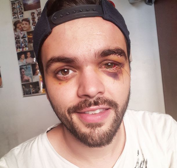 Castellari fue atacado el 1º de diciembre por un grupo de ocho hombres