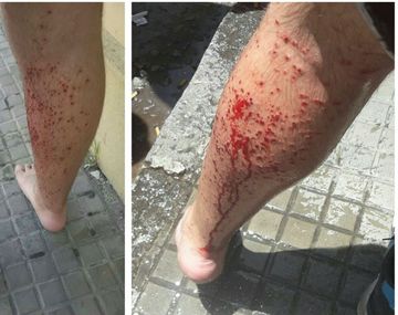 Así resultaron heridos los dos adolescentes