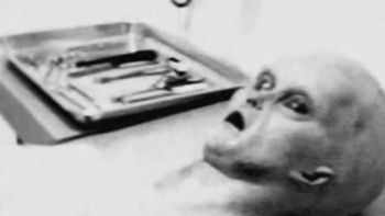 prueba indicaria que la autopsia a un alien fue real prueba indicaria que la autopsia a un alien fue real