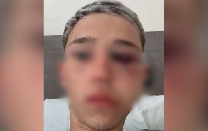 Estremecedor audio de uno de los rugbiers: Le agarré la cabeza y le di con la rodilla