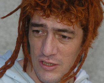 El cantante Pity Álvarez permanece internado