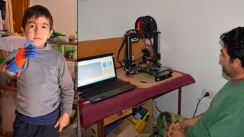 sin saber de ortopedia, construyo una protesis para su hijo sin saber de ortopedia, construyo una protesis para su hijo