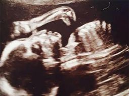 encuentran un dinosaurio en una ecografia de bebe encuentran un dinosaurio en una ecografia de bebe