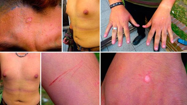 Miramar: denuncian a policías por secuestrar y torturar a un militante gay de 17 años