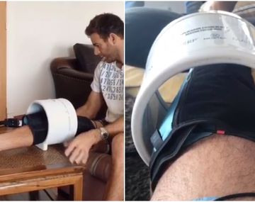 Juan Martín Del Potro se recupera de la lesión que lo marginó del circuito