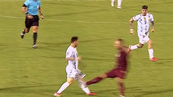 Scaloni habló del estado físico de Messi tras la patada que el crack recibió en el partido con Venezuela