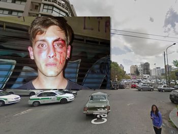 Sufrió una brutal golpiza en La Plata