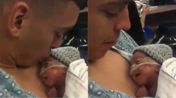 Sonrisa de un bebé prematuro